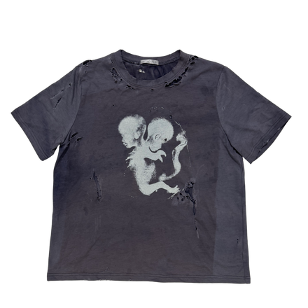 INSECT BITTEN T SHIRTS